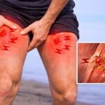 What Is DOMS? Why Your Muscles Are Sore After Exercise